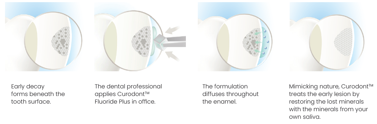 Curodont™ Repair Fluoride Plus